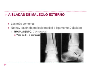    AISLADAS DE MALEOLO EXTERNO

       Las más comunes
       No hay lesión de maleolo medial o ligamento Deltoideo
           TRATAMIENTO. Conservador
               Yeso de 6 – 8 semanas
 