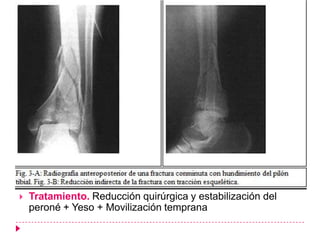    Tratamiento. Reducción quirúrgica y estabilización del
    peroné + Yeso + Movilización temprana
 