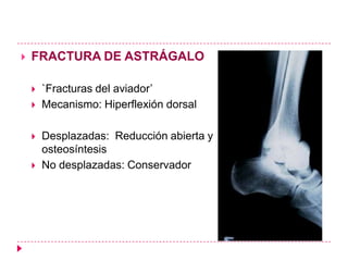    FRACTURA DE ASTRÁGALO

       `Fracturas del aviador‘
       Mecanismo: Hiperflexión dorsal

       Desplazadas: Reducción abierta y
        osteosíntesis
       No desplazadas: Conservador
 
