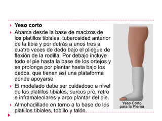    Yeso corto
   Abarca desde la base de macizos de
    los platillos tibiales, tuberosidad anterior
    de la tibia y por detrás a unos tres a
    cuatro veces de dedo bajo el pliegue de
    flexión de la rodilla. Por debajo incluye
    todo el pie hasta la base de los ortejos y
    se prolonga por plantar hasta bajo los
    dedos, que tienen así una plataforma
    donde apoyarse
   El modelado debe ser cuidadoso a nivel
    de los platillos tibiales, surcos pre, retro
    e inframaleolares y arco plantar del pie.
   Almohadillado en torno a la base de los
    platillos tibiales, tobillo y talón.
 