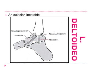    Articulación inestable
 