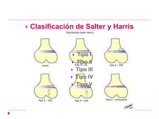    Clasificación de Salter y Harris


                     Tipo I
                    Tipo II
                    Tipo III
                    Tipo IV
                    Tipo V
 