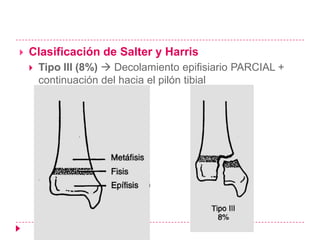    Clasificación de Salter y Harris
       Tipo III (8%)  Decolamiento epifisiario PARCIAL +
        continuación del hacia el pilón tibial
 