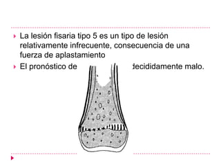    La lesión fisaria tipo 5 es un tipo de lesión
    relativamente infrecuente, consecuencia de una
    fuerza de aplastamiento
   El pronóstico de esta lesión es decididamente malo.
 