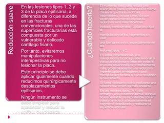 En las lesiones tipos 1, 2 y                       El momento ideal para reducir una
Reducción suave




                                                  ¿Cuándo hacerla?
                                                                     lesión de la placa epifisaria es el mismo
                  3 de la placa epifisaria, a                        día en el que ha sucedido el
                  diferencia de lo que sucede                        traumatismo, ya que a medida que
                                                                     vayan transcurriendo los días la
                  en las fracturas                                   reducción será más dificultosa.
                  convencionales, una de las                         Incluso, transcurridos 10 días es difícil
                  superficies fracturarias está                      la
                  compuesta por un                                   manipulación de los fragmentos sin
                                                                     usar
                  vulnerable y delicado
                                                                     una fuerza excesiva, especialmente en
                  cartílago fisario.                                 las
                  Por tanto, evitaremos                              lesiones tipos 1 y 2.
                  manipulaciones                                     En estas circunstancias, una
                                                                     manipulación forzada puede lesionar la
                  intempestivas para no                              placa cartilaginosa y debe ser evitada;
                  lesionar la placa.                                 en estas situaciones es probablemente
                                                                     más prudente aceptar una reducción
                  Este principio se debe                             imperfecta que arriesgarse a una
                                                                     manipulación forzada o a una reducción
                  aplicar igualmente cuando                          a cielo abierto.
                  reducimos quirúrgicamente                          Si fuera necesario podría realizarse una
                  desplazamientos                                    osteotomía correctora más adelante.
                  epifisarios.                                       En las lesiones tipos 3 y 4, sin
                                                                     embargo, una reducción tardía, aunque
                  Ningún instrumento se                              no es deseable, si es preferible con el
                                                                     objeto de reducir adecuadamente el
                  debe emplear para                                  fragmento desplazado y restaurar la
                  apalancar y reducir la                             superficie articular.
                  epífisis desplazada.
 