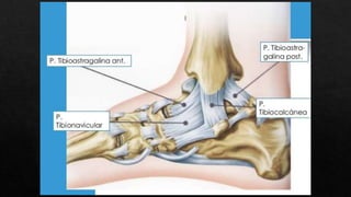 FRACTURA DE TOBILLO.pptx