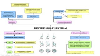 Pilon Definicion Fractura de tobillo-esquema para traumatología.pptx