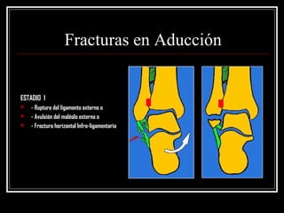 Fracturas en Aducción


ESTADIO 1
   - Ruptura del ligamento externo o
   - Avulsión del maléolo externo o
   - Fractura horizontal Infra-ligamentaria
 