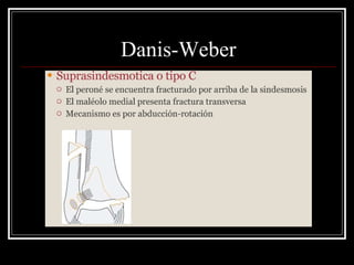 Danis-Weber
 