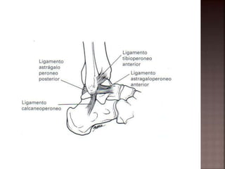 Fractura de tobillo | PPTX