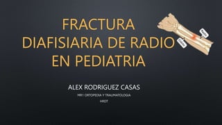 FRACTURA
DIAFISIARIA DE RADIO
EN PEDIATRIA
ALEX RODRIGUEZ CASAS
MR1 ORTOPEDIA Y TRAUMATOLOGIA
HRDT
 