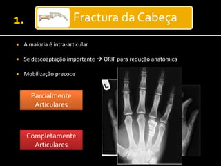 Fractura da Cabeça
 A maioria é intra-articular
 Se descoaptação importante  ORIF para redução anatómica
 Mobilização precoce
Parcialmente
Articulares
Completamente
Articulares
 