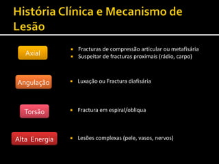 Axial
Angulação
Torsão
Alta Energia
 Fracturas de compressão articular ou metafisária
 Suspeitar de fracturas proximais (rádio, carpo)
 Luxação ou Fractura diafisária
 Fractura em espiral/obliqua
 Lesões complexas (pele, vasos, nervos)
 