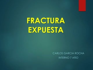 FRACTURA
EXPUESTA
CARLOS GARCIA ROCHA
INTERNO 7 AÑO
 
