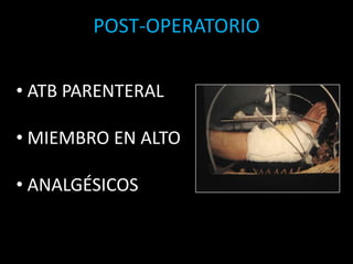  PRIMARIO DIFERIDO ( 7 a 10 días)  