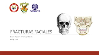 FRACTURAS FACIALES
Dr. Luis Alejandro Torrontegui Zazueta
R1 ORL y CCC
 