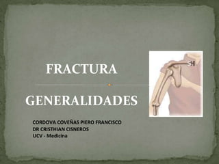 FRACTURA
GENERALIDADES
CORDOVA COVEÑAS PIERO FRANCISCO
DR CRISTHIAN CISNEROS
UCV - Medicina
 