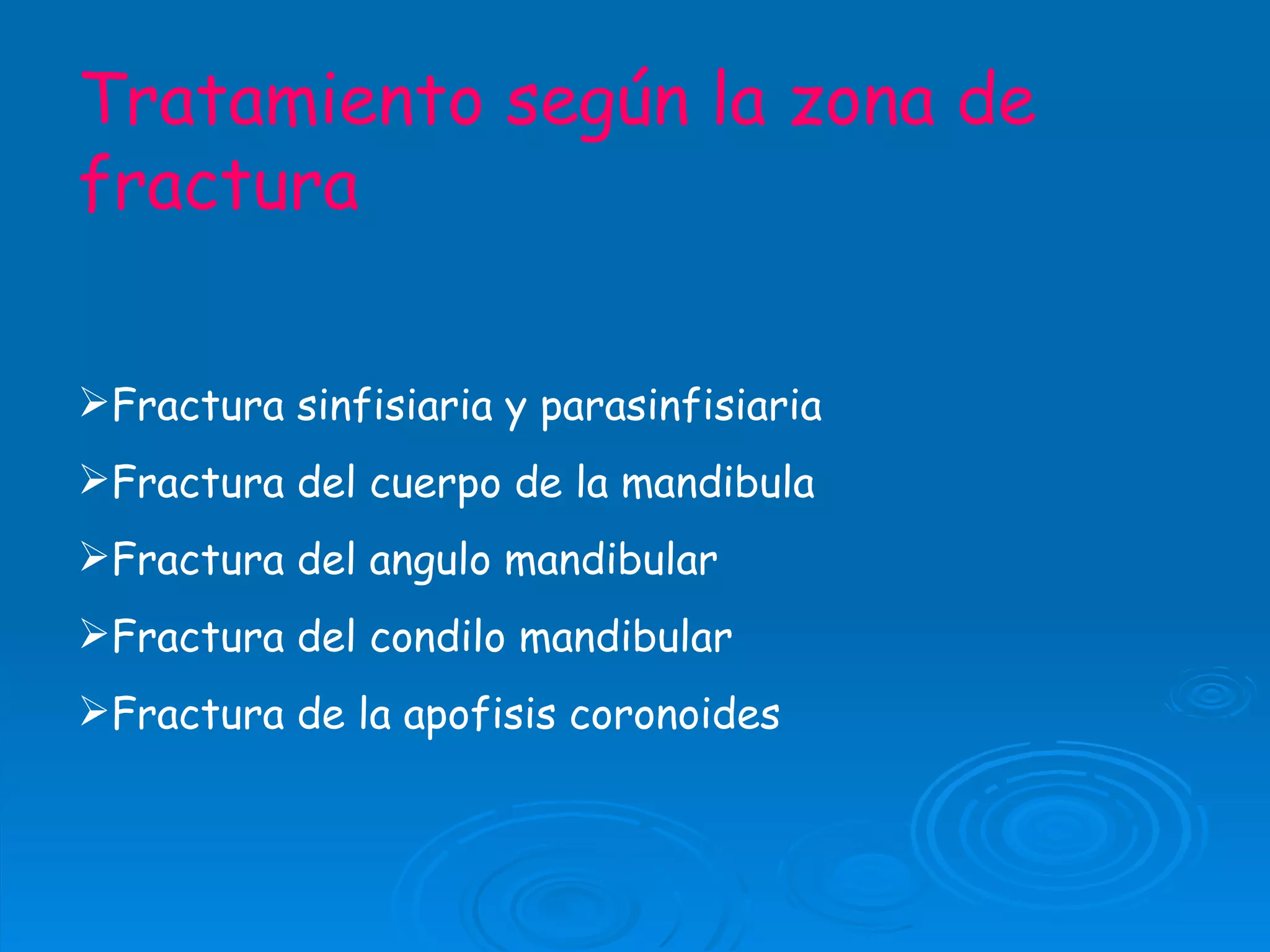 FRACTURA MANDIBULAR | PPT