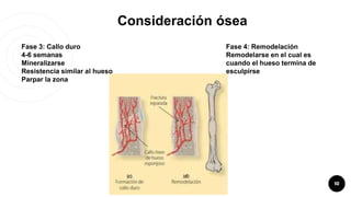 10
Consideración ósea
Fase 3: Callo duro
4-6 semanas
Mineralizarse
Resistencia similar al hueso
Parpar la zona
Fase 4: Rem...