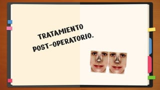 TRATAMIENTO
POST-OPERATORIO.
 