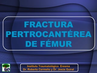 FRACTURA
PERTROCANTÉREA
DE FÉMUR
Instituto Traumatológico Eresma
Dr. Roberto Cermeño y Dr. Jesús Guiral

 