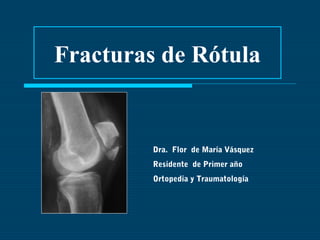Fracturas de Rótula 
Dra. Flor de María Vásquez 
Residente de Primer año 
Ortopedia y Traumatología 
 