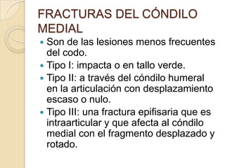 FRACTURAS DEL EPICÓNDILO MEDIALTx. postoperatorio:Férula durante 4 semanas.Cabestrillo que permita el movimiento del codo pero evite la dorsiflexión forzada de la muñeca o supinación del antebrazo.6 semanas, se retira la aguja o tornillo