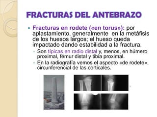 FRACTURAS DEL ANTEBRAZOMas frecuente en los niñoscerca de 45% de todas las fracturas en la infancia 62% de la extremidad superiorLas fracturas son menos complicadas que en el adultoLas fracturas del tercio distal son extremadamente comunes75%              tercio distal15 al 18%      tercio medio7%                tercio proximal.
