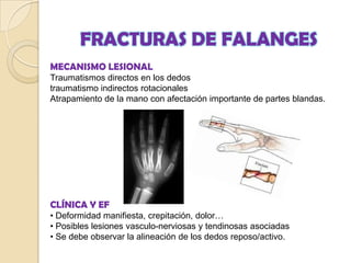 FRACTURAS DE MUÑECA Y MANO