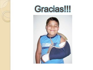 FRACTURAS DE FALANGESMECANISMO LESIONALTraumatismos directos en los dedos traumatismo indirectos rotacionalesAtrapamientode la mano con afectación importante de partes blandas. CLÍNICA Y EF• Deformidad manifiesta, crepitación, dolor…• Posibles lesiones vasculo-nerviosas y tendinosas asociadas• Se debe observar la alineación de los dedos reposo/activo. 