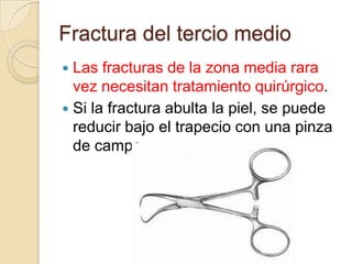 Por el contrario Wilkes y Hoffer describieron 38 fracturas de clavícula  en niños con lesiones craneoencefálicas, las cuales consolidaron todas sin inmovilización y  desarrollaron  remodelación excelente  conservando íntegramente los arcos de movilidad.