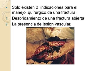 Fractura del tercio medioLas fracturas de la zona media rara vez necesitan tratamiento quirúrgico.Si la fractura abulta la piel, se puede  reducir bajo el trapecio con una pinza de campo.