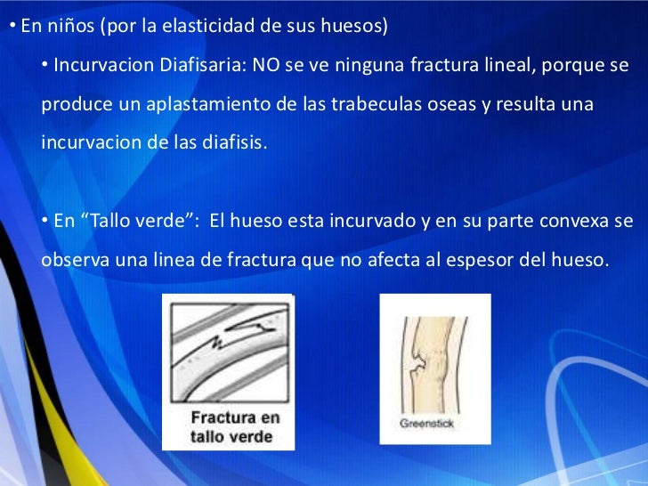 Quien consiguió aumentar el miembro
