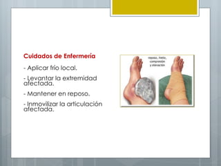 Cuidados de Enfermería
 
    - Aplicar frío local.
 
    - Levantar la extremidad
    afectada.
 
    - Mantener en reposo.
 
    - Inmovilizar la articulación
    afectada.
 