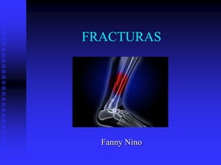 FRACTURAS
Fanny Nino
 