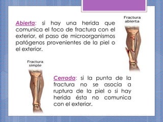 Cerrada: si la punta de la
fractura no se asocia a
ruptura de la piel o si hay
herida ésta no comunica
con el exterior.
Abierta: si hay una herida que
comunica el foco de fractura con el
exterior, el paso de microorganismos
patógenos provenientes de la piel o
el exterior.
 