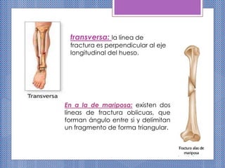 transversa: la línea de
fractura es perpendicular al eje
longitudinal del hueso.
En a la de mariposa: existen dos
líneas de fractura oblicuas, que
forman ángulo entre si y delimitan
un fragmento de forma triangular.
 