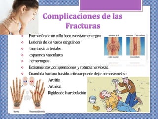  Formacióndeuncalloóseoexcesivamentegrande.
 Lesionesdelos vasossanguíneos
 trombosis arteriales
 espasmos vasculares
 hemorragias
 Estiramientos,comprensiones y roturasnerviosas.
 Cuandolafracturahasidoarticularpuededejarcomosecuelas:
Artritis
Artrosis
Rigidezdelaarticulación
 