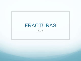 FRACTURAS
D.N.S
 
