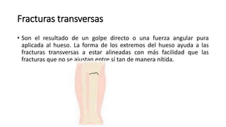 Fracturas transversas
• Son el resultado de un golpe directo o una fuerza angular pura
aplicada al hueso. La forma de los extremos del hueso ayuda a las
fracturas transversas a estar alineadas con más facilidad que las
fracturas que no se ajustan entre sí tan de manera nítida.
 