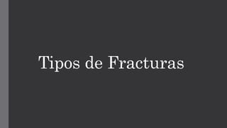 Tipos de Fracturas
 