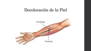 Decoloración de la Piel
 