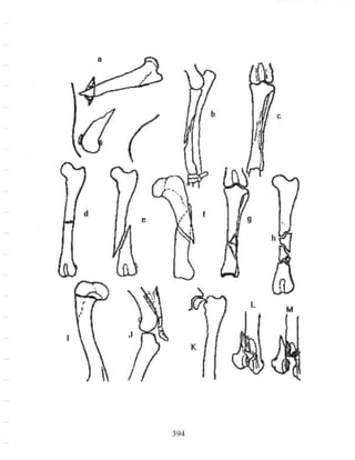 Fracturas