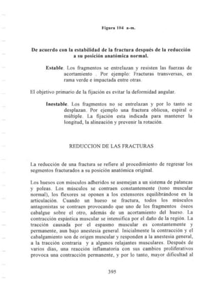 Fracturas