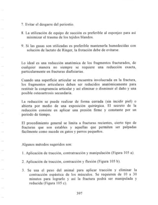 Fracturas
