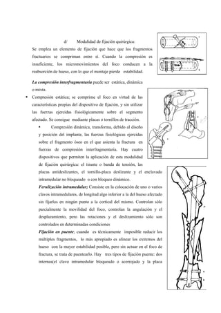 19
d/ Modalidad de fijación quirúrgica:
Se emplea un elemento de fijación que hace que los fragmentos
fractuarios se compriman entre sí. Cuando la compresión es
insuficiente, los micromovimientos del foco conducen a la
reabsorción de hueso, con lo que el montaje pierde estabilidad.
La compresión interfragmentaria puede ser estática, dinámica
o mixta.
Compresión estática; se comprime el foco en virtud de las
características propias del dispositivo de fijación, y sin utilizar
las fuerzas ejercidas fisiológicamente sobre el segmento
afectado. Se consigue mediante placas o tornillos de tracción.
Compresión dinámica, transforma, debido al diseño
y posición del implante, las fuerzas fisiológicas ejercidas
sobre el fragmento óseo en el que asienta la fractura en
fuerzas de compresión interfragmentaria. Hay cuatro
dispositivos que permiten la aplicación de esta modalidad
de fijación quirúrgica: el tirante o banda de tensión, las
placas antideslizantes, el tornillo-placa deslizante y el enclavado
intramedular no bloqueado o con bloqueo dinámico.
Ferulización intramedular; Consiste en la colocación de uno o varios
clavos intramedulares, de longitud algo inferior a la del hueso afectado
sin fijarlos en ningún punto a la cortical del mismo. Controlan sólo
parcialmente la movilidad del foco, controlan la angulación y el
desplazamiento, pero las rotaciones y el deslizamiento sólo son
controlados en determinadas condiciones
Fijación en puente; cuando es técnicamente imposible reducir los
múltiples fragmentos, lo más apropiado es alinear los extremos del
hueso con la mayor estabilidad posible, pero sin actuar en el foco de
fractura, se trata de puentearlo. Hay tres tipos de fijación puente: dos
internas(el clavo intramedular bloqueado o acerrojado y la placa
 