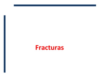 Fracturas
 