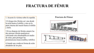 FRACTURA DE FÉMUR
1. Acueste la víctima sobre la espalda.
2.Coloque dos férulas así: una desde
la axila hasta el tobillo y otra en la
parte interna del muslo hasta el tobillo
y átela.
3.Si no dispone de férulas amarre las
dos piernas (férula anatómica)
colocando una almohadilla en medio
de estas, para proteger las
prominencias óseas (rodilla y tobillo).
4.Anude una venda en forma de ocho
alrededor de los pies.
 
