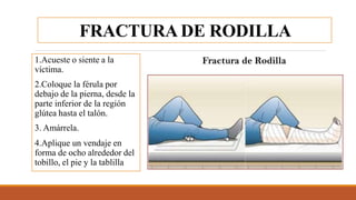 FRACTURA DE RODILLA
1.Acueste o siente a la
víctima.
2.Coloque la férula por
debajo de la pierna, desde la
parte inferior de la región
glútea hasta el talón.
3. Amárrela.
4.Aplique un vendaje en
forma de ocho alrededor del
tobillo, el pie y la tablilla
 