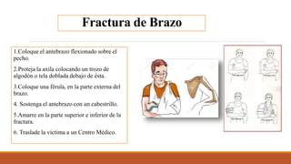 Fractura de Brazo
1.Coloque el antebrazo flexionado sobre el
pecho.
2.Proteja la axila colocando un trozo de
algodón o tela doblada debajo de ésta.
3.Coloque una férula, en la parte externa del
brazo.
4. Sostenga el antebrazo con un cabestrillo.
5.Amarre en la parte superior e inferior de la
fractura.
6. Traslade la víctima a un Centro Médico.
 